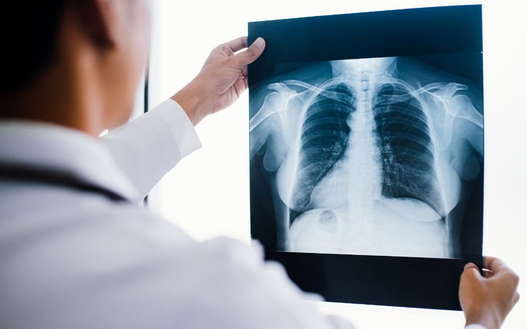 Fakulta technologická bude jako první technická fakulta v Česku vyučovat obor Radiologický asistent