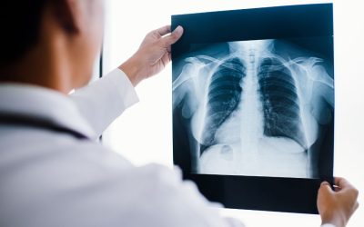 Fakulta technologická bude nově vyučovat obor Radiologický asistent