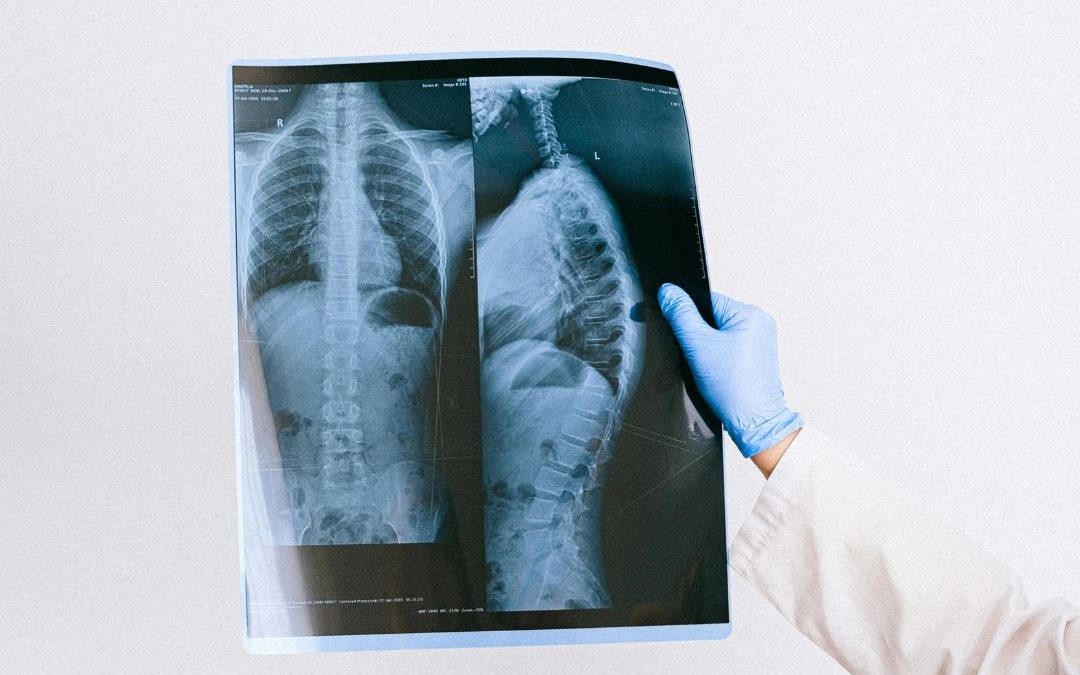 Zlínský kraj přispěje Univerzitě Tomáše Bati na nový studijní program Radiologická asistence