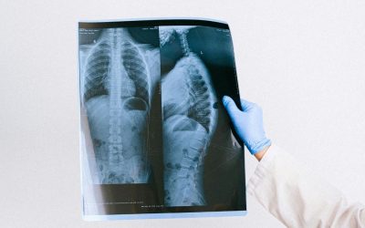 Zlínský kraj přispěje Univerzitě Tomáše Bati na nový studijní program Radiologická asistence